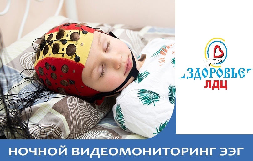 Ночной видеомониторинг ЭЭГ в ООО ЛДЦ 
