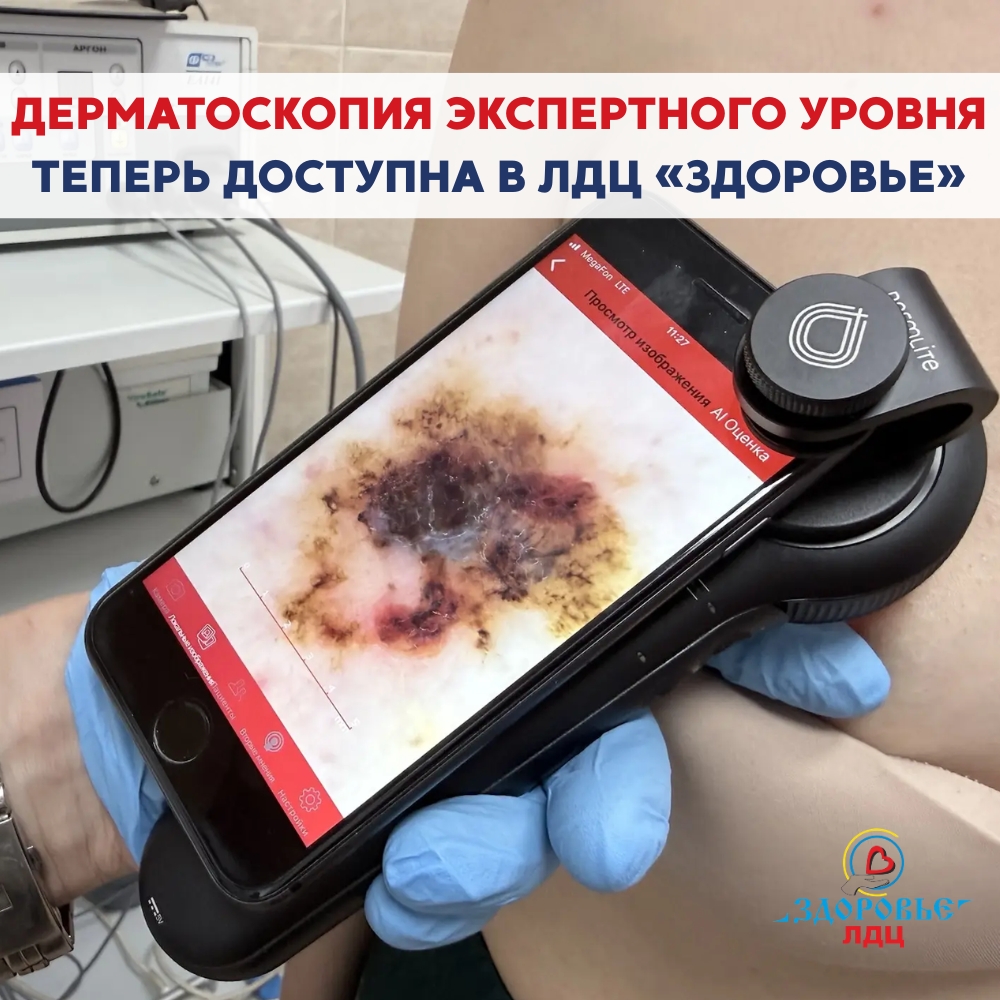 ⚡ДЕРМАТОСКОПИЯ ЭКСПЕРТНОГО УРОВНЯ В ЛДЦ «ЗДОРОВЬЕ»